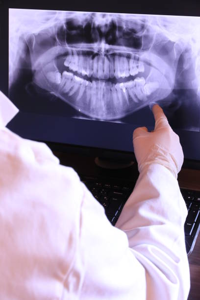 Best Emergency Wisdom Teeth Removal in Summer Set, MO