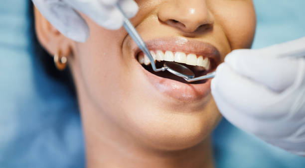 Best Emergency Dental Care for Broken or Chipped Teeth in Summer Set, MO